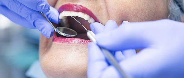 Best Emergency Dental Care for Sports Injuries in Forest Lake, IL